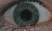 eye